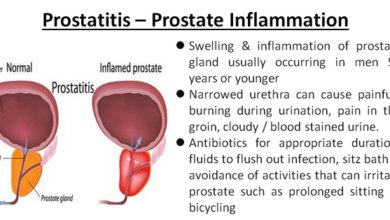 Photo of Prostatitis: foods and medicinal plants for inflammation of the prostate
